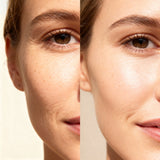 Daily Youth Cream crème jeunesse veloutée anti âge jour certifiée COSMOS NATURAL 50 ml avant après sur contour du visage de femme adulte – KALYAË ORIGIN